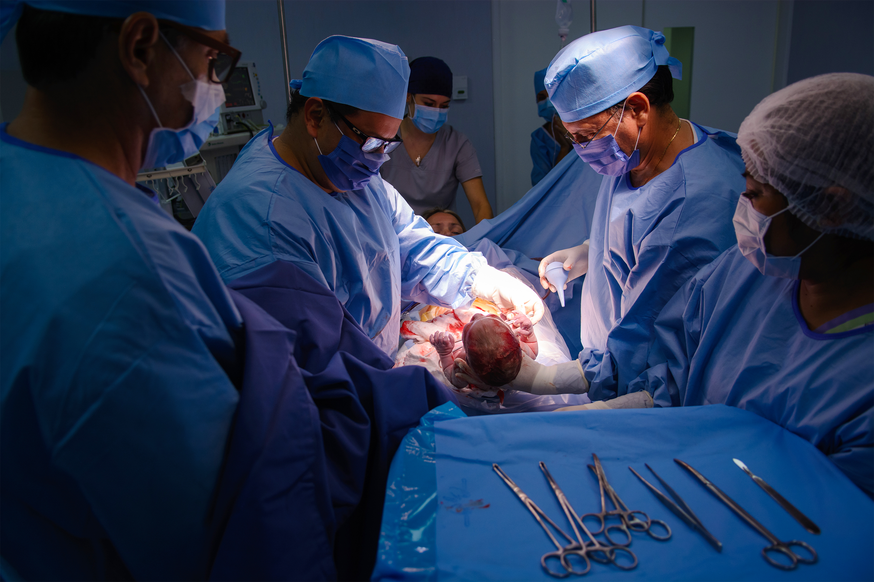 C Section